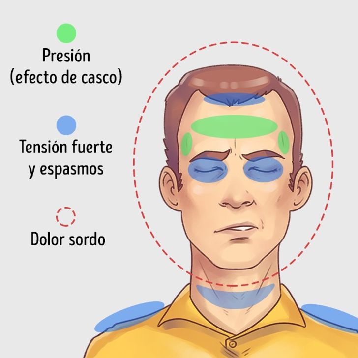 5 Tipos de dolor de cabeza y cómo aliviarlos rápidamente