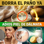 ¡¿Tienes “Piel de Dálmata” por el Sol?! Borra el Paño y las Manchas Oscuras con Jugo de Papa Cruda