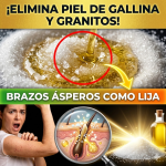 ¡Tus Brazos Parecen Lija! Elimina la “Piel de Gallina” y los Granitos en 3 Minutos con Azúcar