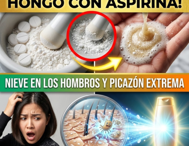 ¡Qué Oso! Tienes “Nieve” en los Hombros: Elimina la Caspa y el Hongo con 5 Pesitos (Receta de Aspirina)