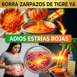 ¡¿Tienes “Zarpazos de Tigre” en tu Piel?! Borra las Estrías Rojas y Repara tu Colágeno con Zanahoria ¡¿Tienes “Zarpazos de Tigre” en tu Piel?! Borra las Estrías Rojas y Repara tu Colágeno con Zanahoria