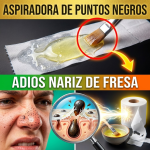 ¡¿Tienes la Nariz como “Fresa”?! Arranca los Puntos Negros de Raíz con la “Aspiradora” de Clara de Huevo