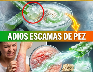 ¡¿Tu Piel Parece “Escamas de Pez” por la Psoriasis?! Apaga el Fuego y Derrite las Costras con Sábila y Avena Helada