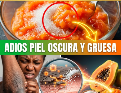 ¡¿Tus Codos o Rodillas Parecen de “Elefante”?! Aclara y Suaviza la Piel Gruesa y Oscura con Papaya ¡¿Tus Codos o Rodillas Parecen de “Elefante”?! Aclara y Suaviza la Piel Gruesa y Oscura con Papaya