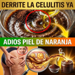 ¡¿Tus Piernas Parecen “Cáscara de Naranja”?! Derrite la Celulitis y Alisa tu Piel con Café y Aceite de Oliva