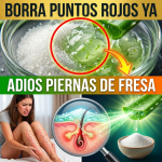 ¡¿Tus Piernas Parecen “Fresa”?! Borra los Puntitos Rojos y Vellos Enterrados con Sábila y Azúcar ¡¿Tus Piernas Parecen “Fresa”?! Borra los Puntitos Rojos y Vellos Enterrados con Sábila y Azúcar