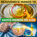 ¡¿Tienes “Manos de Lija”?! Rejuvenece tu Piel 20 Años en una Sola Noche con Vaselina y Dólar de Oliva ¡¿Tienes “Manos de Lija”?! Rejuvenece tu Piel 20 Años en una Sola Noche con Vaselina y Dólar de Oliva