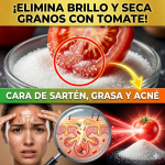 ¡Tu Cara Parece Sartén! Elimina el Brillo y Seca los Granos con el “Exfoliante Rojo” de Doña Tomata
