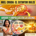 ¿Te Quemaste Cocinando? El Milagro de la Miel Cruda para Aliviar el Ardor y Evitar Ampollas al Instante ¿Te Quemaste Cocinando? El Milagro de la Miel Cruda para Aliviar el Ardor y Evitar Ampollas al Instante