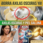 ¿Axilas Oscuras y Piel de Gallina? El Borrador Mágico de Papa y Bicarbonato que Aclara tu Piel al Instante