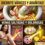 ¿Venas Saltadas y Dolorosas? El “Aceite Destapacaños” de Ajo que Borra las Várices y Te Deja Piernas de Seda