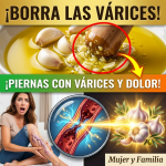 ¡Borra el Mapa de tus Piernas! El Milagro Casero de Ajo y Aceite para Eliminar las Várices