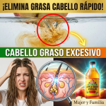 ¡El Secreto Revelado! La “Proporción de Oro” Exacta de Vinagre de Manzana para Eliminar el Cabello Graso en Minutos
