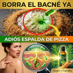 ¿Tu Espalda Parece “Campo Minado”? El Exterminador Casero para Borrar el Bacné para Siempre