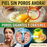 ¡Adiós a los Cráteres! El Secreto de la “Proporción de Oro” con Huevo y Limón para una Piel Sin Poros