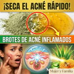 ¡El Secreto de Porcelana! La “Proporción Exacta” de Arcilla y Miel para Secar el Acné en 15 Minutos (Sin Quemar tu Rostro) ¡El Secreto de Porcelana! La “Proporción Exacta” de Arcilla y Miel para Secar el Acné en 15 Minutos (Sin Quemar tu Rostro)