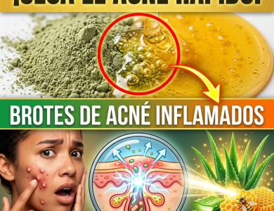 ¡El Secreto de Porcelana! La “Proporción Exacta” de Arcilla y Miel para Secar el Acné en 15 Minutos (Sin Quemar tu Rostro) ¡El Secreto de Porcelana! La “Proporción Exacta” de Arcilla y Miel para Secar el Acné en 15 Minutos (Sin Quemar tu Rostro)