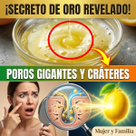 ¡Borra los Poros Gigantes AHORA! Revelado el “Secreto de Oro” con la Proporción Exacta de Clara de Huevo y Limón para No Quemarte