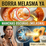 ¡Adiós al Melasma! El Secreto de la Papaya y el Yogur con la Proporción Exacta para Borrar Manchas sin Quemar tu Piel