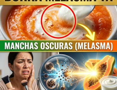 ¡Adiós al Melasma! El Secreto de la Papaya y el Yogur con la Proporción Exacta para Borrar Manchas sin Quemar tu Piel