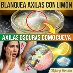 ¿Tienes las axilas oscuras como “cueva” y te da pena levantar los brazos? El secreto de la abuela con Limón y Azúcar
