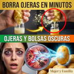 ¿Tienes ojos de “mapache” y luces siempre cansada? El secreto crudo que borra ojeras en minutos ¿Tienes ojos de “mapache” y luces siempre cansada? El secreto crudo que borra ojeras en minutos