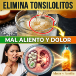 El Secreto del “Gran Jefe Vinagre”: La Proporción Exacta y los Minutos Precisos para Destruir los Tonsilolitos (¡Peligro si lo haces mal!) El Secreto del “Gran Jefe Vinagre”: La Proporción Exacta y los Minutos Precisos para Destruir los Tonsilolitos (¡Peligro si lo haces mal!)