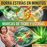 ¿Harta de las “Marcas de Tigre”? Cómo la Magia Gelatinosa del Aloe Vera Puede Borrar las Estrías ¿Harta de las “Marcas de Tigre”? Cómo la Magia Gelatinosa del Aloe Vera Puede Borrar las Estrías