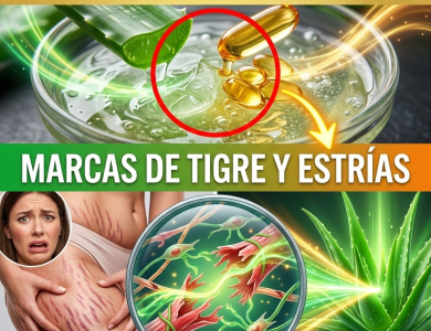 ¿Harta de las “Marcas de Tigre”? Cómo la Magia Gelatinosa del Aloe Vera Puede Borrar las Estrías ¿Harta de las “Marcas de Tigre”? Cómo la Magia Gelatinosa del Aloe Vera Puede Borrar las Estrías