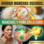 El Secreto del “Doctor Papa”: La Proporción Exacta y los 20 Minutos Precisos para Borrar Manchas Oscuras (¡Peligro si lo haces mal!)