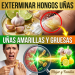 El Secreto Antimicótico: La Proporción Exacta y los 12 Minutos Precisos para Destruir el Hongo de las Uñas (¡Peligro si lo haces mal!)