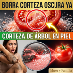 ¿Tienes Codos y Rodillas como “Corteza de Árbol” Sucia? El Remedio Rojo para Blanquearlos ¿Tienes Codos y Rodillas como “Corteza de Árbol” Sucia? El Remedio Rojo para Blanquearlos