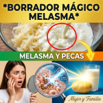 El Secreto de la “Señora Papa”: La Proporción Exacta y los 20 Minutos Precisos para Borrar el Melasma (¡Peligro si lo haces mal!)