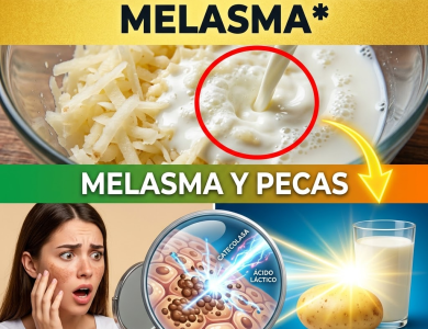 El Secreto de la “Señora Papa”: La Proporción Exacta y los 20 Minutos Precisos para Borrar el Melasma (¡Peligro si lo haces mal!) El Secreto de la “Señora Papa”: La Proporción Exacta y los 20 Minutos Precisos para Borrar el Melasma (¡Peligro si lo haces mal!)
