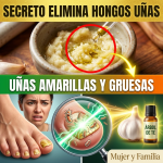 El Secreto del “Doctor Ajo”: La Proporción Exacta y las 8 Horas Precisas para Destruir los Hongos de las Uñas (¡Peligro si lo haces mal!)