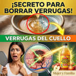 El Secreto de la “Doctora Vinagre”: La Proporción Exacta y los Minutos Precisos para Borrar las Verrugas del Cuello (¡Peligro si lo haces mal!) El Secreto de la “Doctora Vinagre”: La Proporción Exacta y los Minutos Precisos para Borrar las Verrugas del Cuello (¡Peligro si lo haces mal!)
