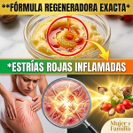 El Secreto de la “Señora Karité”: La Proporción Exacta y los 15 Minutos Precisos para Borrar las Estrías Rojas (¡Peligro si lo haces mal!)